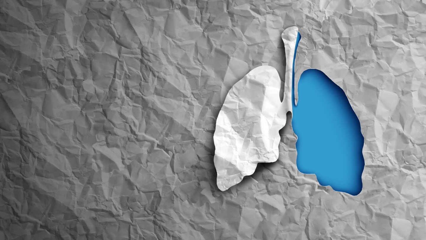 bms’-phase-3-win-for-lung-drug-clouded-by-high-dose-miss