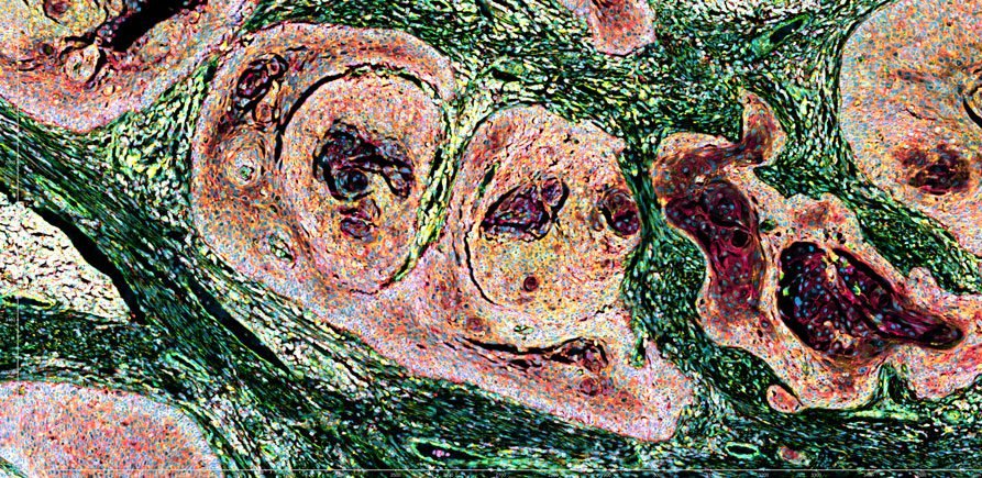 Spatial Biology Moves Toward Translation