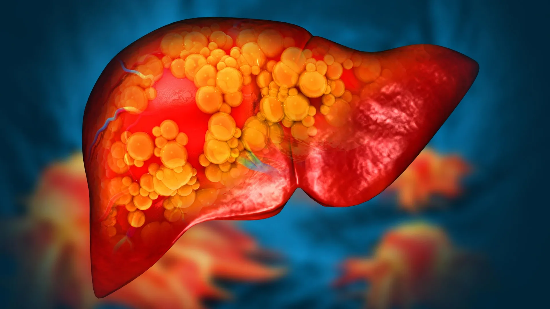 new-drug-reverses-severe-fatty-liver-disease-by-repairing-the-gut